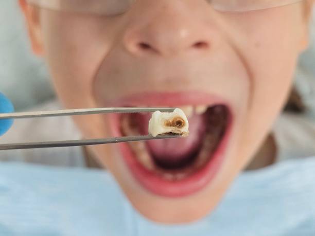 Best Weekend Emergency Dentist in Krebs, OK